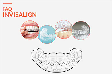 faq invisalign